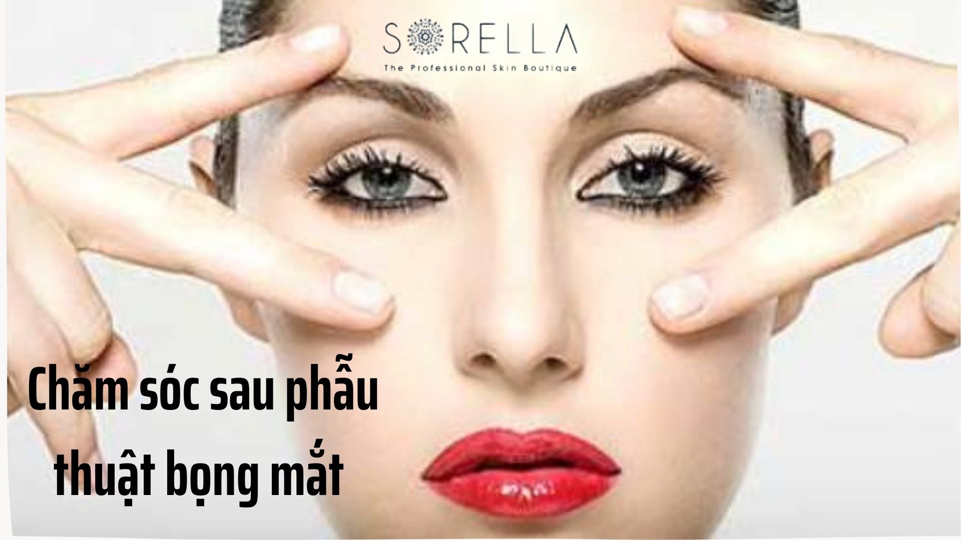 4 điều cần biết về phẫu thuật bọng mắt