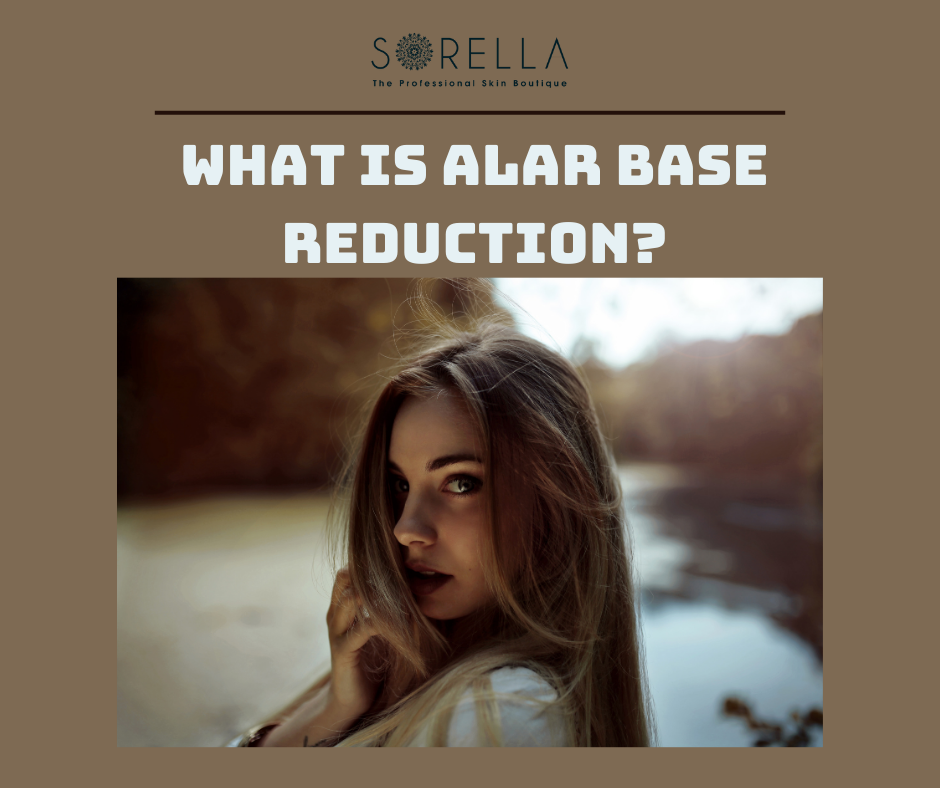 What is Alar Base Reduction?