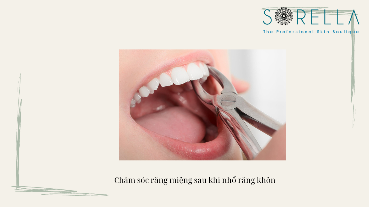 Tại sao nhổ răng khôn bị đau họng?