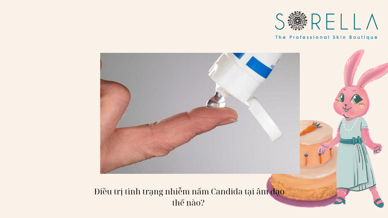 Viêm âm đạo do nấm Candida vùng kín