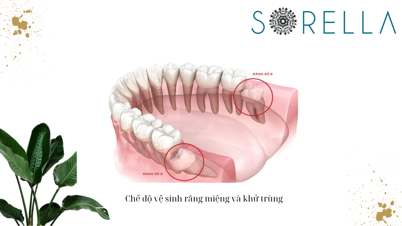 Niềng răng có cần nhổ răng khôn không? 