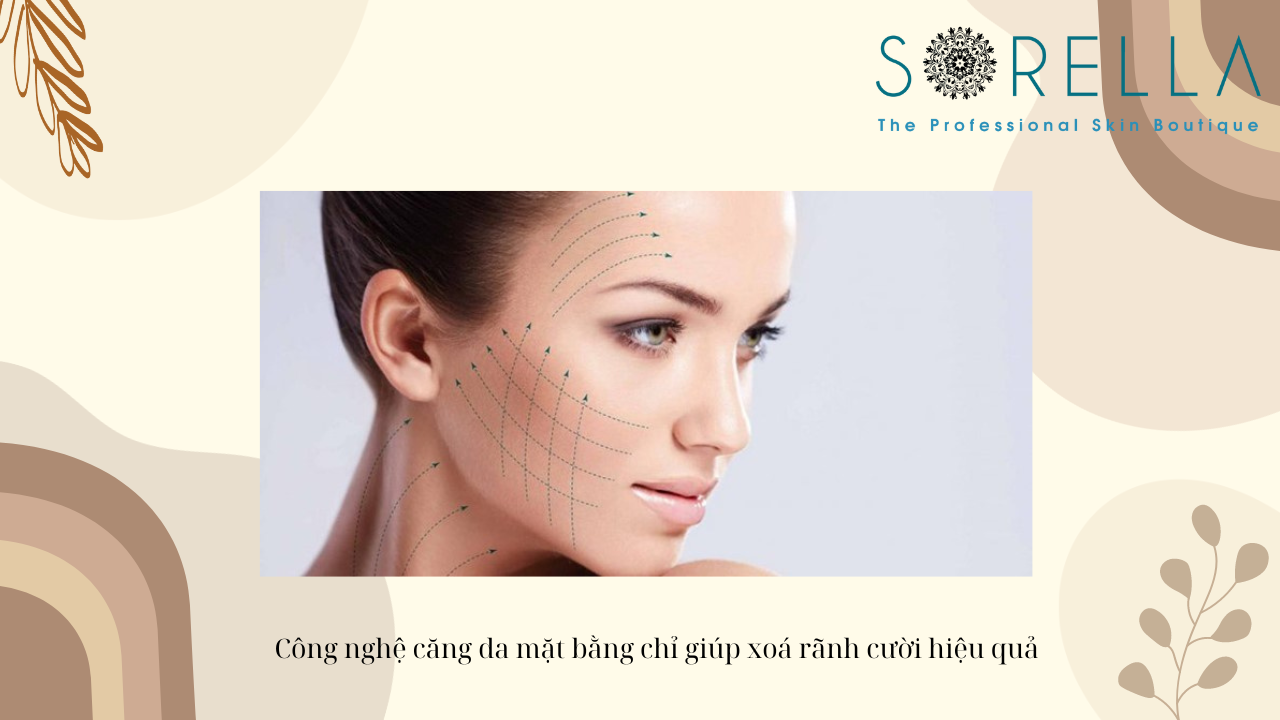 Rãnh cười sâu là gì? 