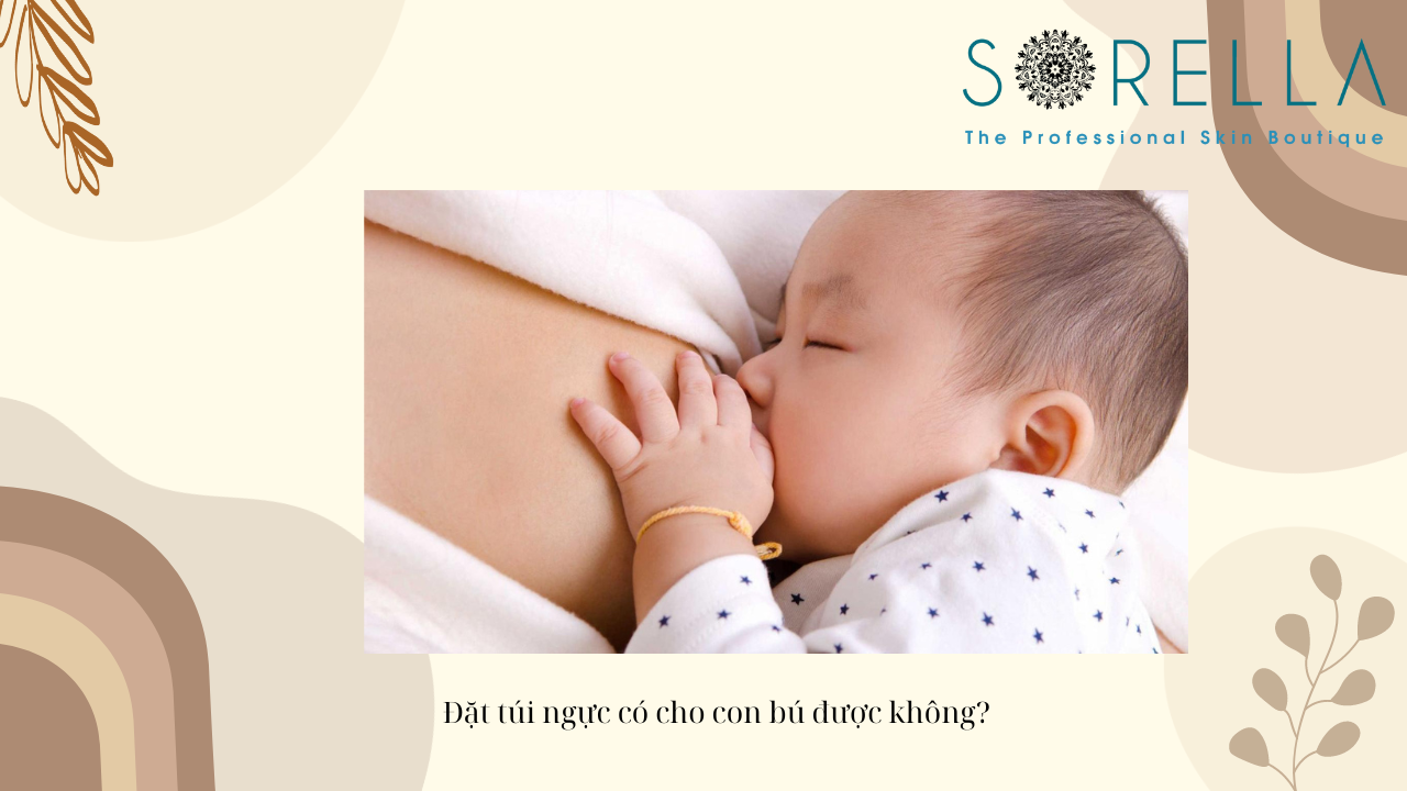 Đặt túi ngực có cho con bú được không?  