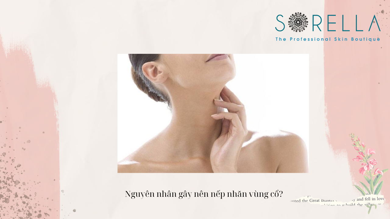 Nguyên nhân gây nên nếp nhăn vùng cổ? 