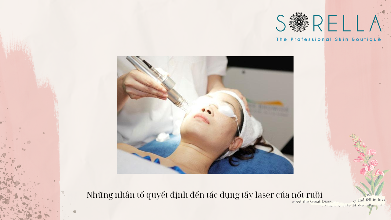 Tẩy nốt ruồi bằng laser có để lại sẹo không?