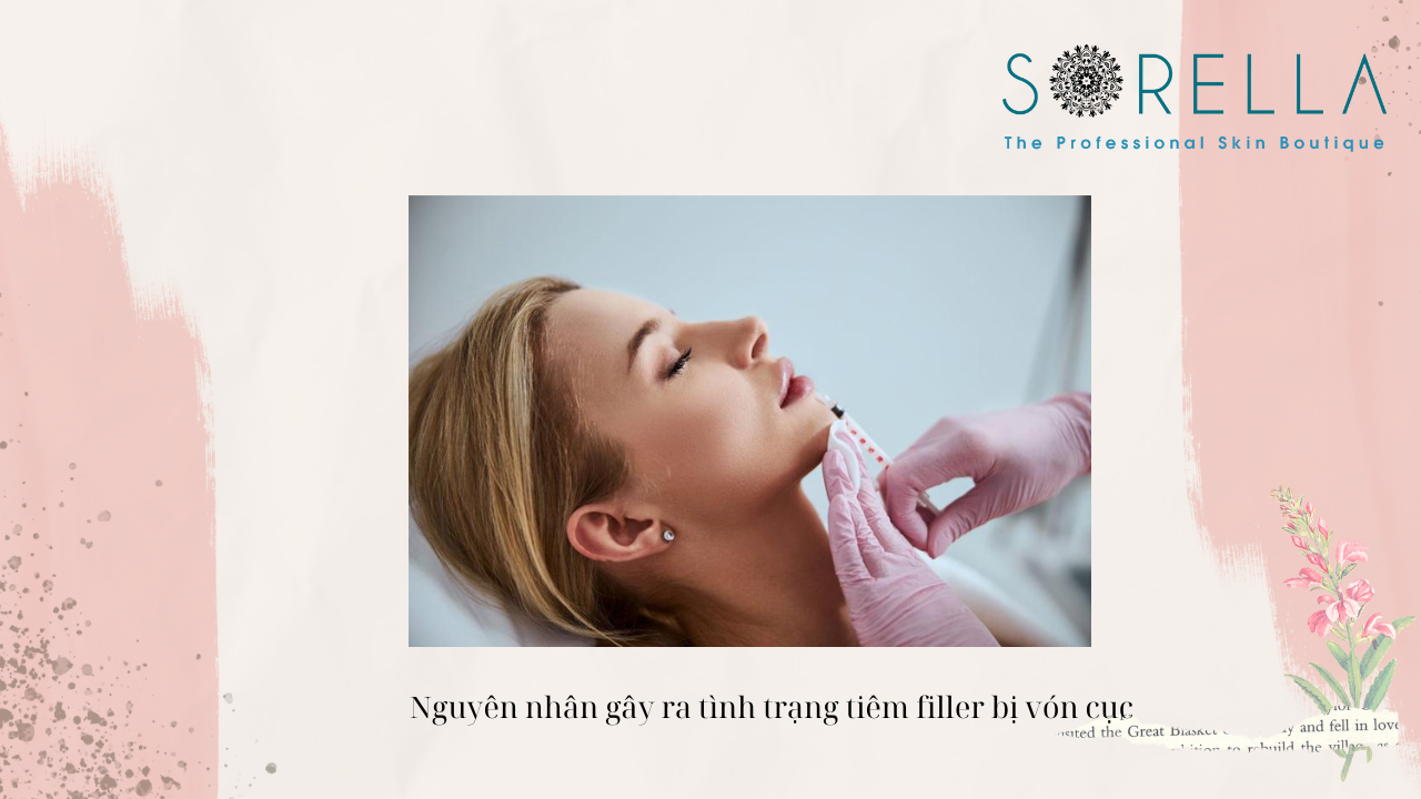 Tiêm filler bị vón cục có nguy hiểm không?