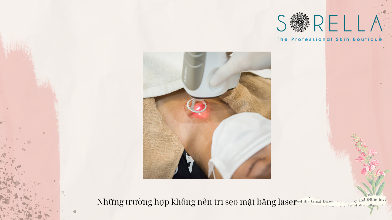 Bắn laser trị sẹo là như thế nào? 