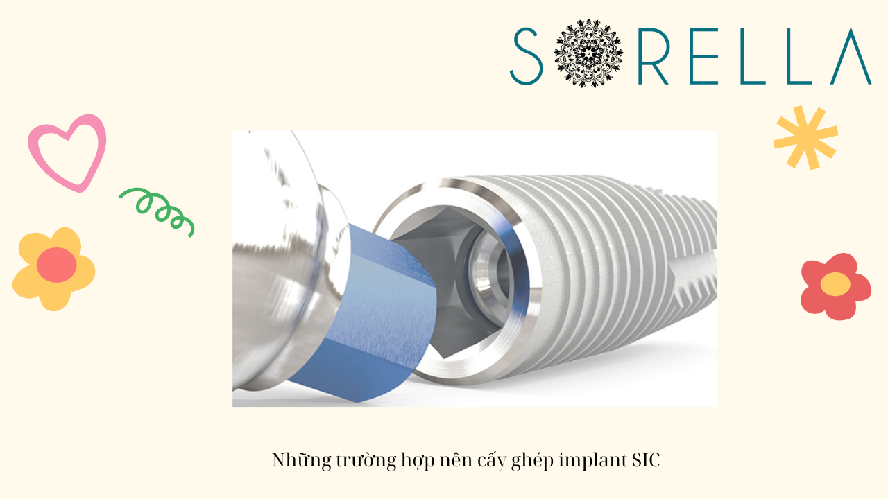 Trụ Implant SIC