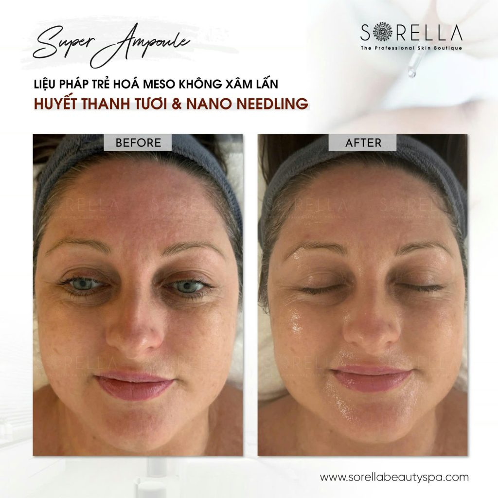 Super Ampoule Skin Booster