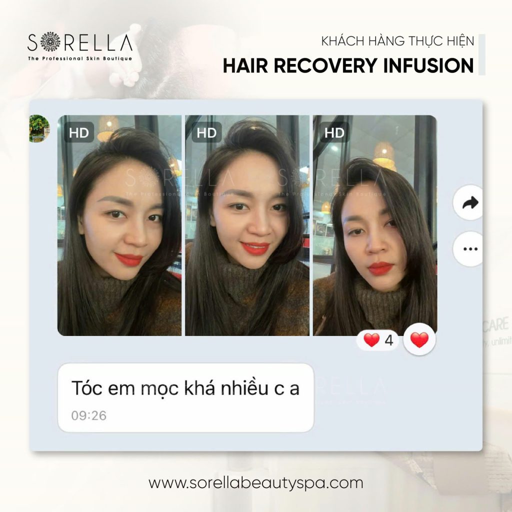 MESO HAIR REVIVE
