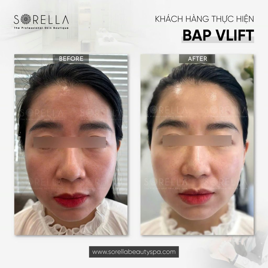 Reshape Face Map