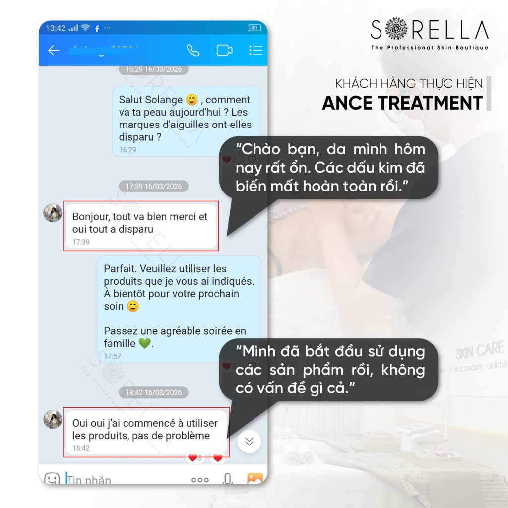 MESO ACNE CLEAR - trước & sau