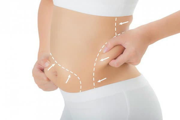 Meso Fat Reduction
