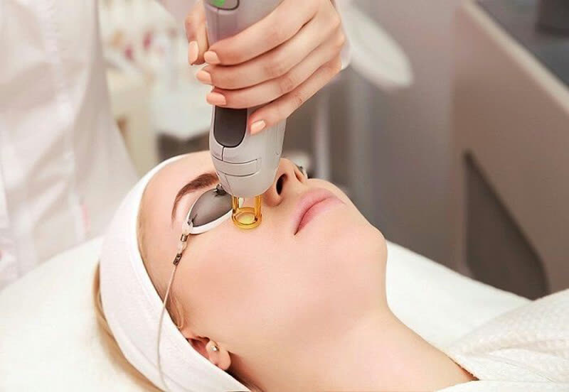 Fotona 6D Laser Lifting