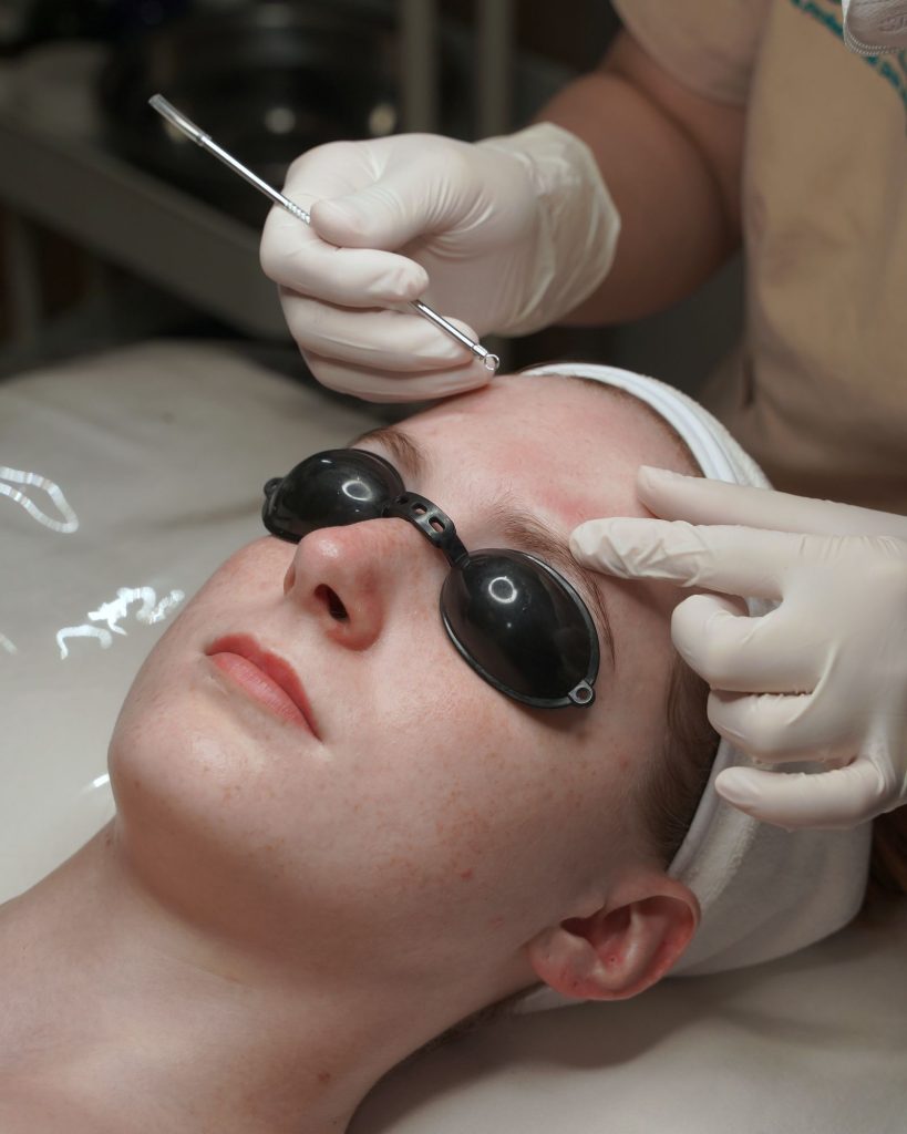 Oxijet Acne Clear at Sorella