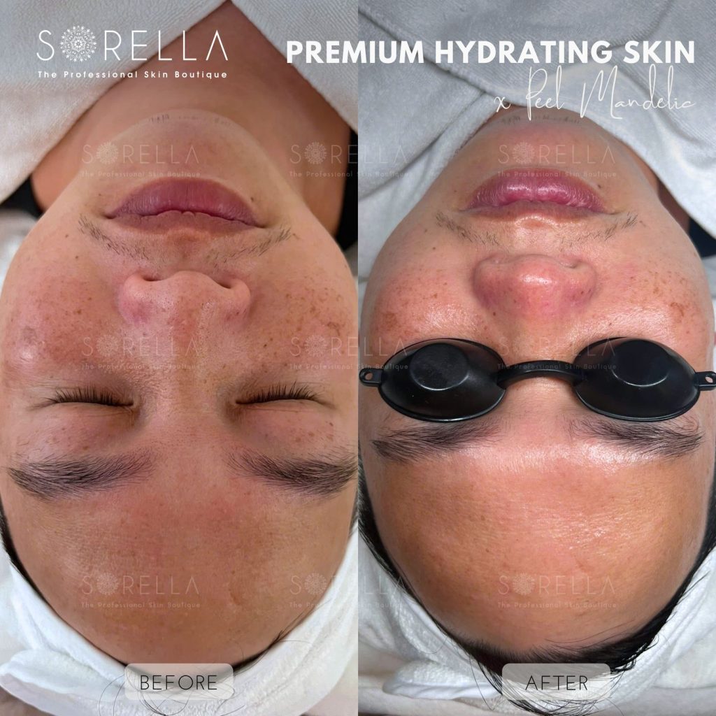 Before and after: Premium Hydrating Skin at Sorella