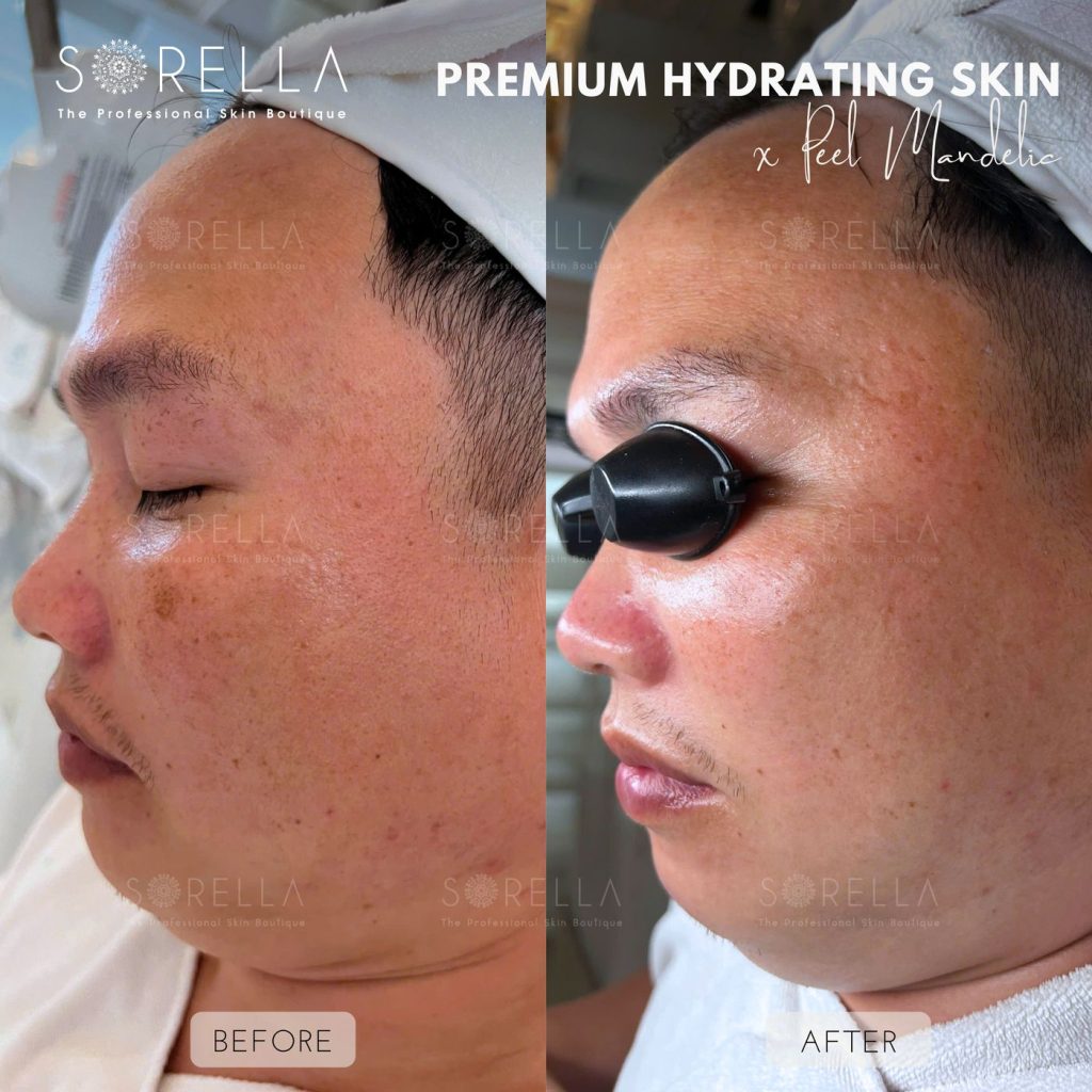 Before and after: Premium Hydrating Skin at Sorella