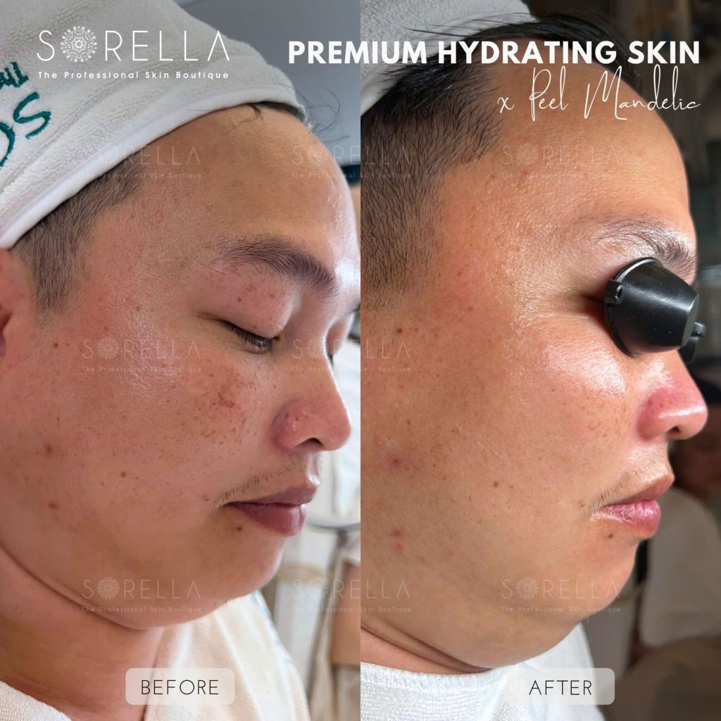 Before and after: Premium Hydrating Skin at Sorella