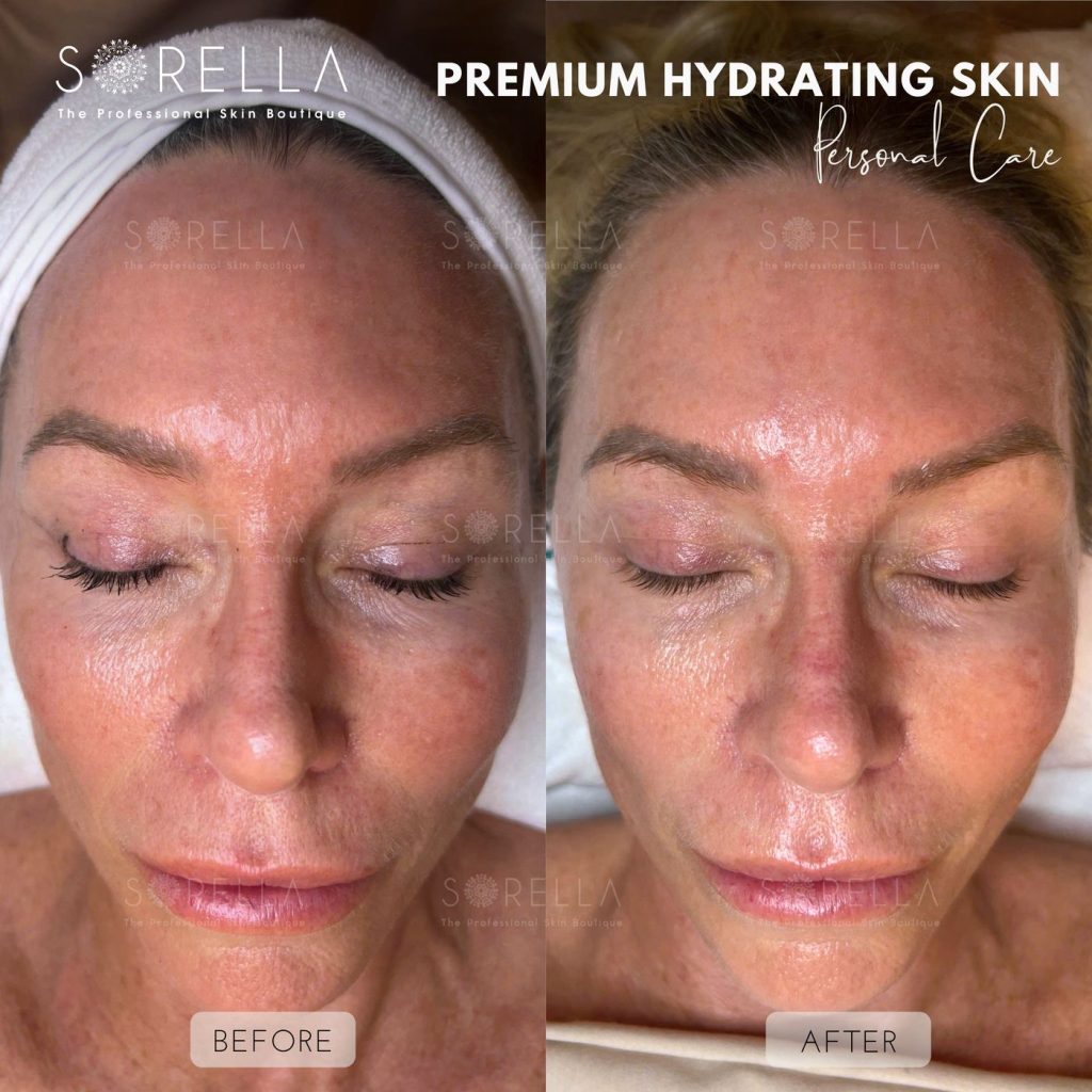 Before and after: Premium Hydrating Skin at Sorella