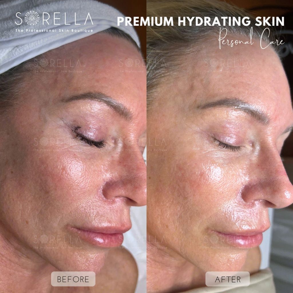 Before and after: Premium Hydrating Skin at Sorella