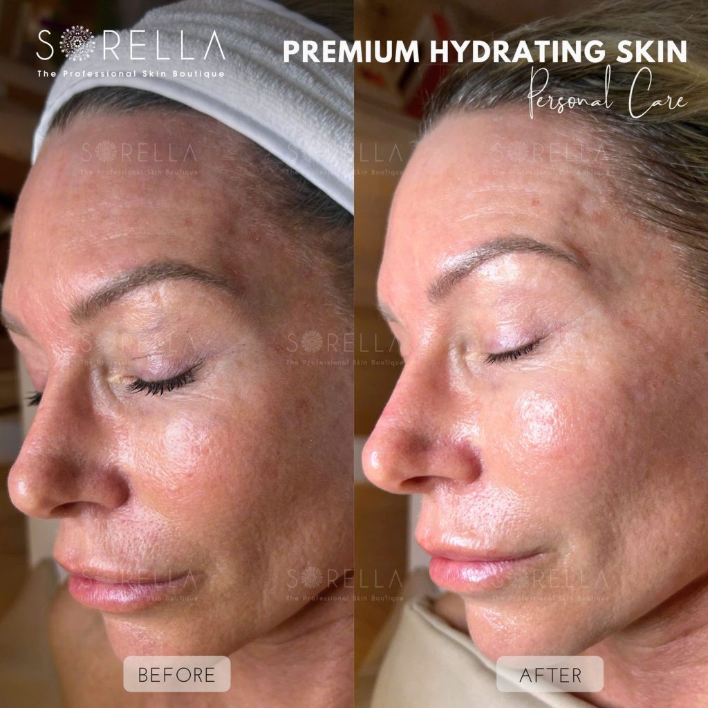 Before and after: Premium Hydrating Skin at Sorella