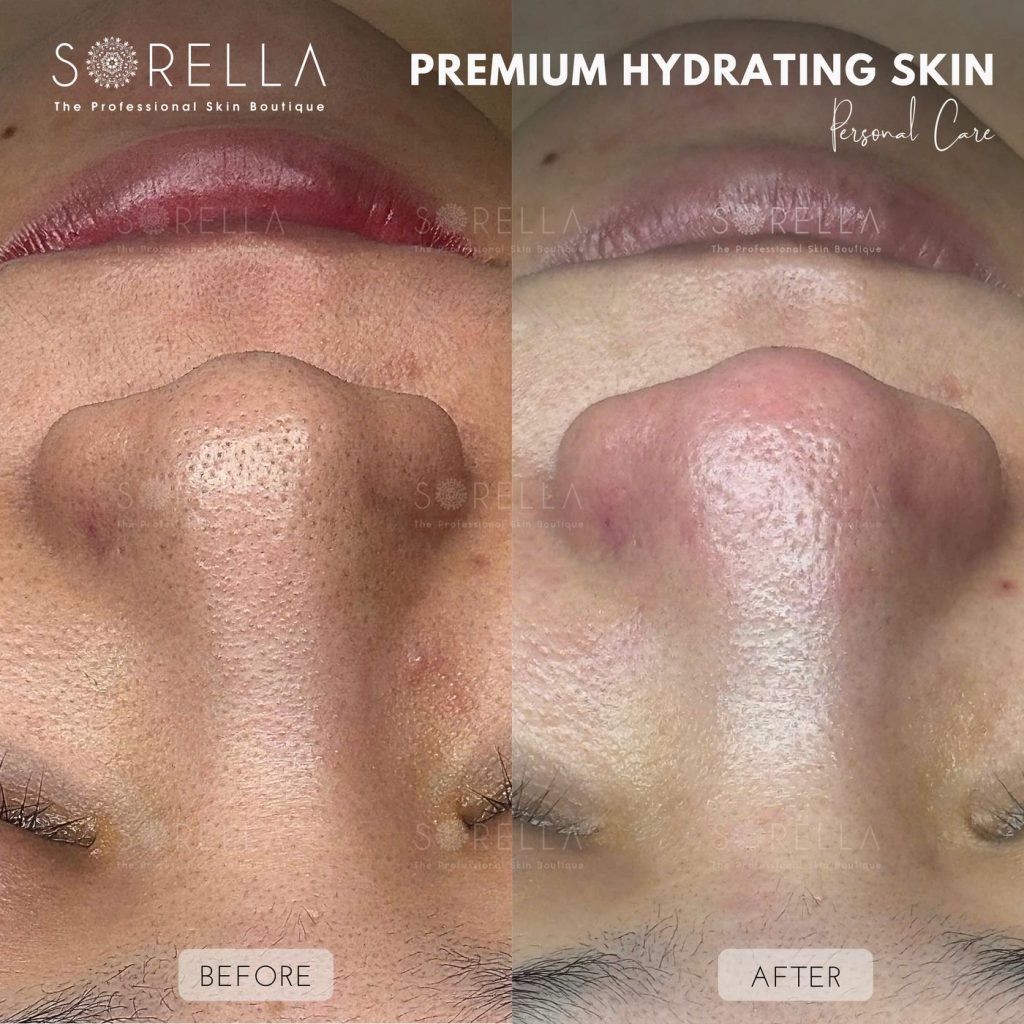 Before and after: Premium Hydrating Skin at Sorella