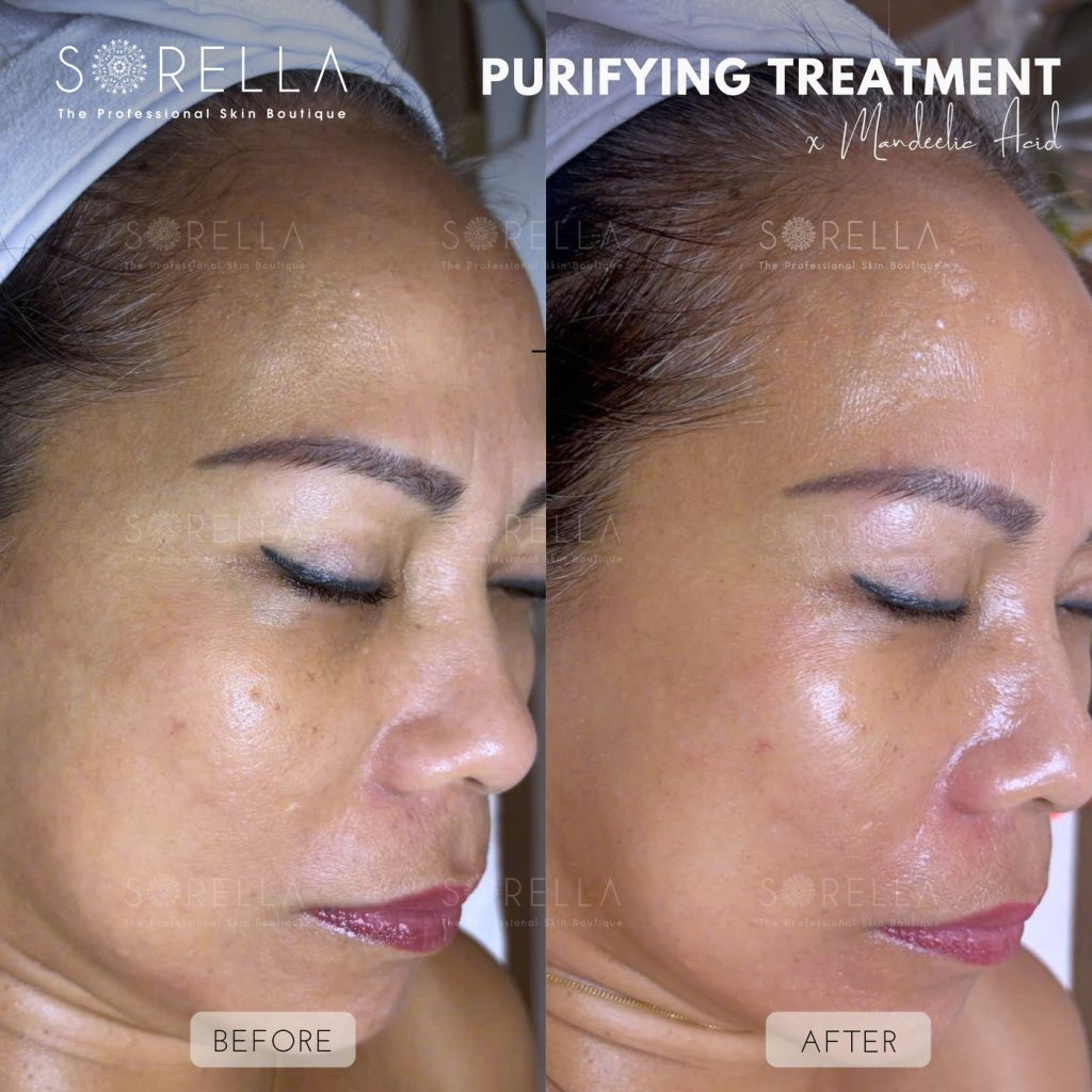 Before and after: Peel Mandelic at Sorella