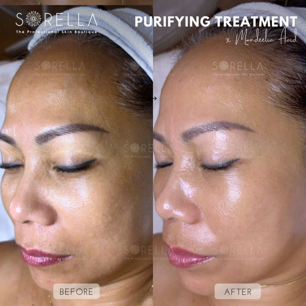 Before and after: Peel Mandelic at Sorella
