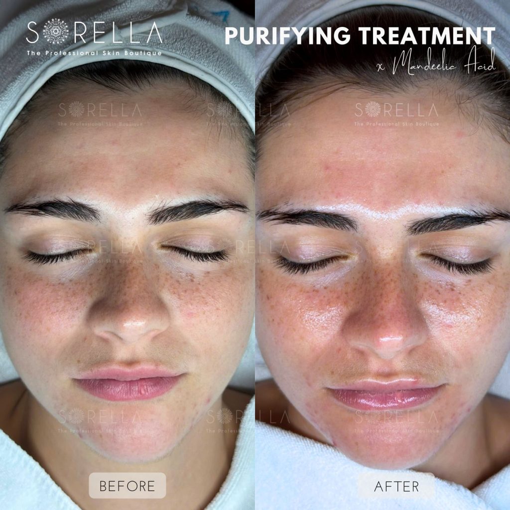 Before and after: Peel Mandelic at Sorella