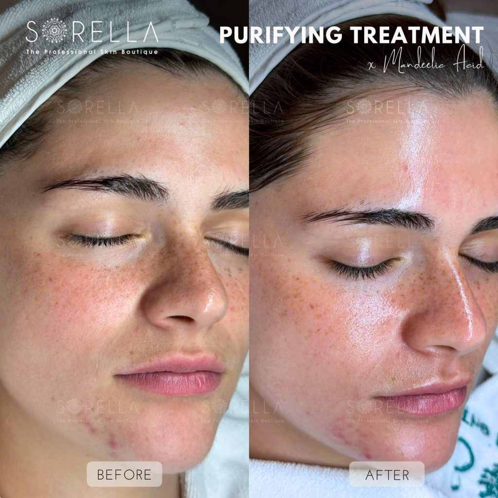 Before and after: Peel Mandelic at Sorella