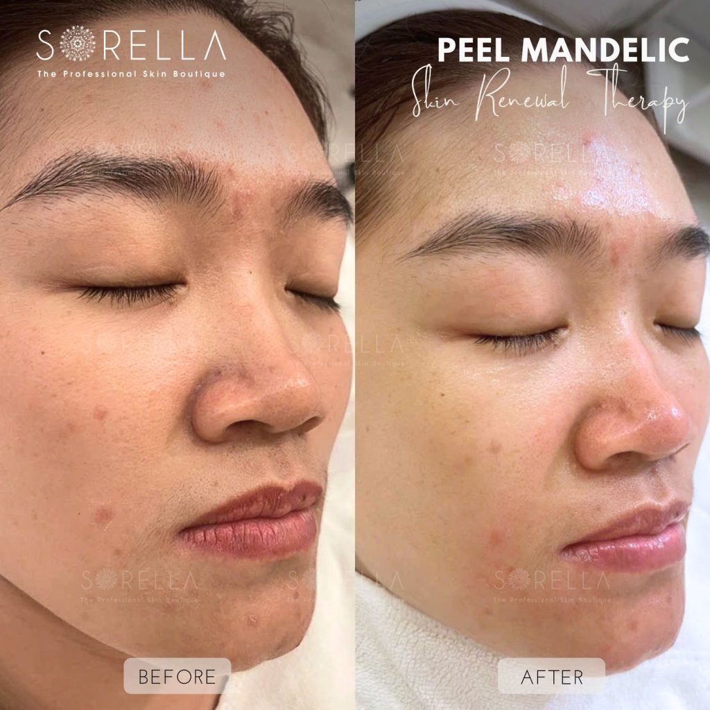 Before and after: Peel Mandelic at Sorella