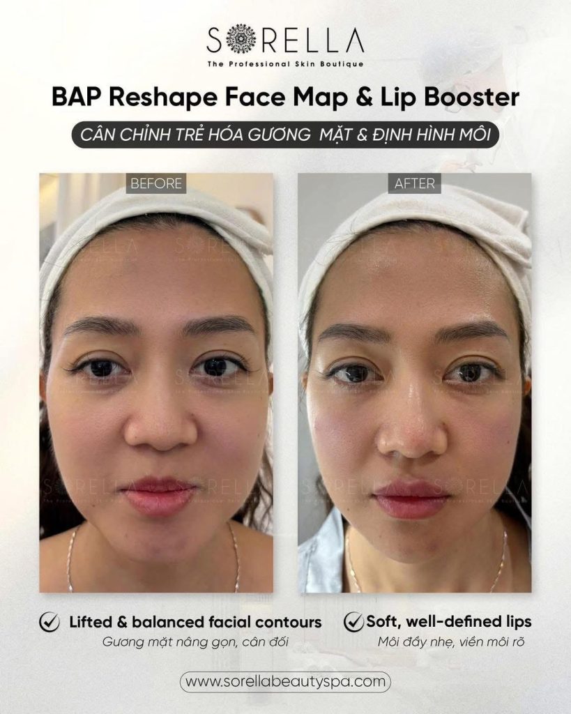 Before and after: BAP Reshape Face Map & Lip Booster at Sorella