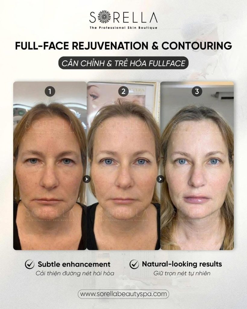 Before and after: Full-face Rejuvenation & Contouring at Sorella