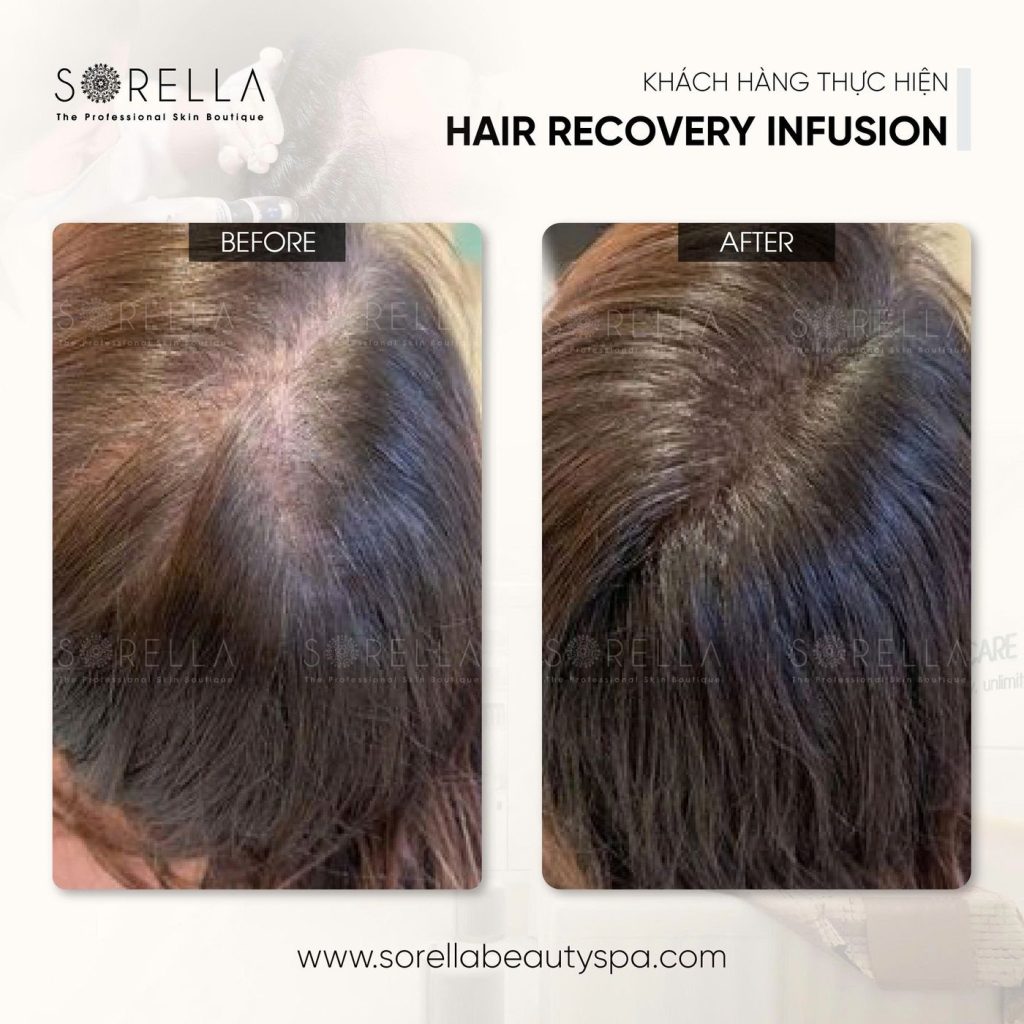 Before and after: Hair Recovery Infusion at Sorella