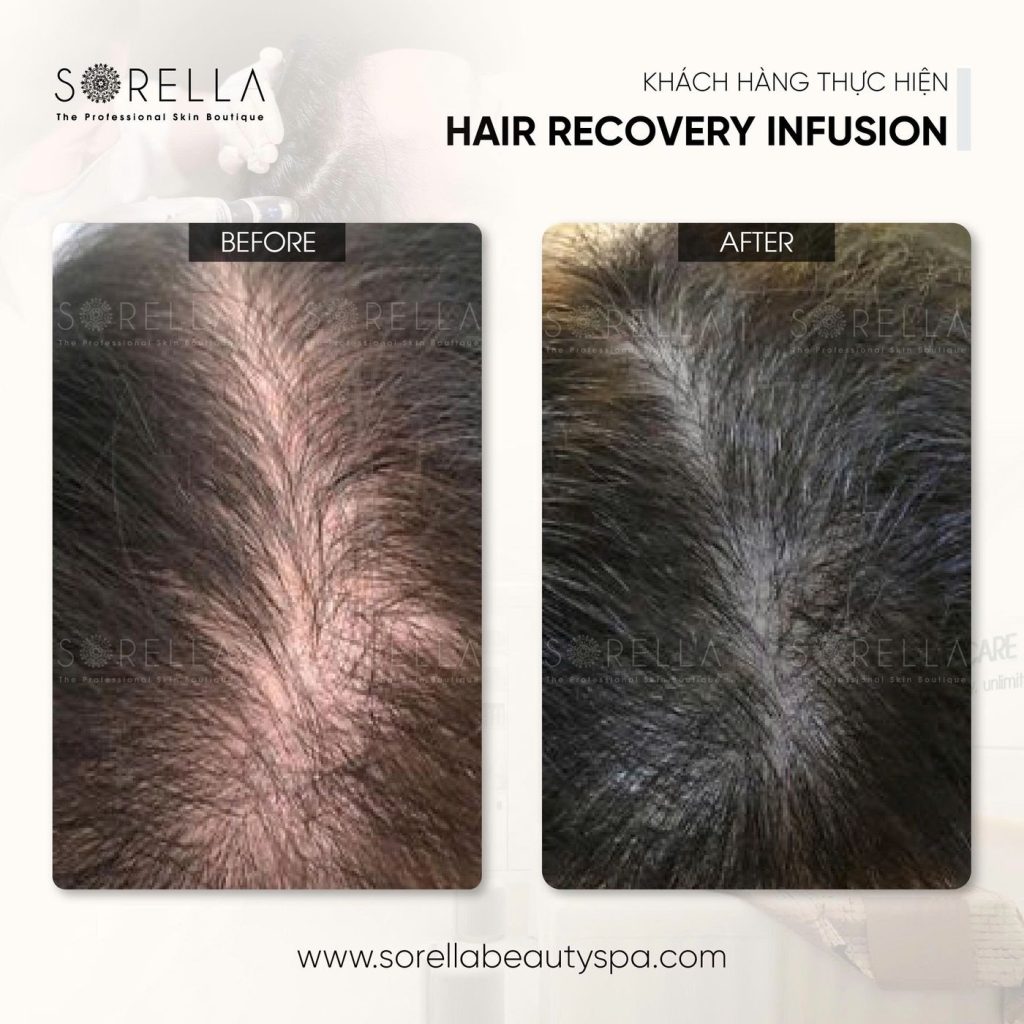 Before and after: Hair Recovery Infusion at Sorella