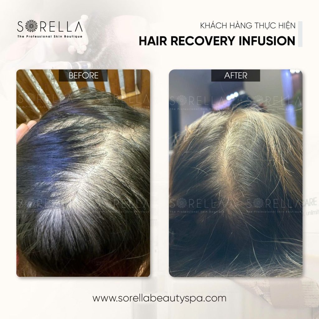 Before and after: Hair Recovery Infusion at Sorella
