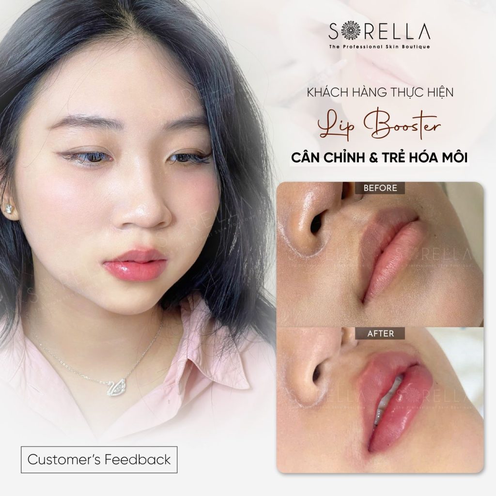 Before and after: Lip Booster at Sorella