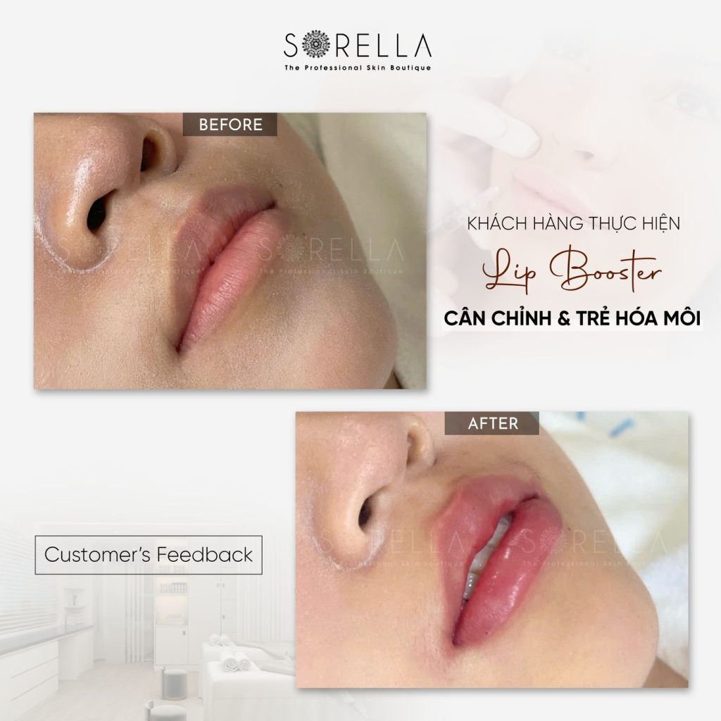Before and after: Lip Booster at Sorella