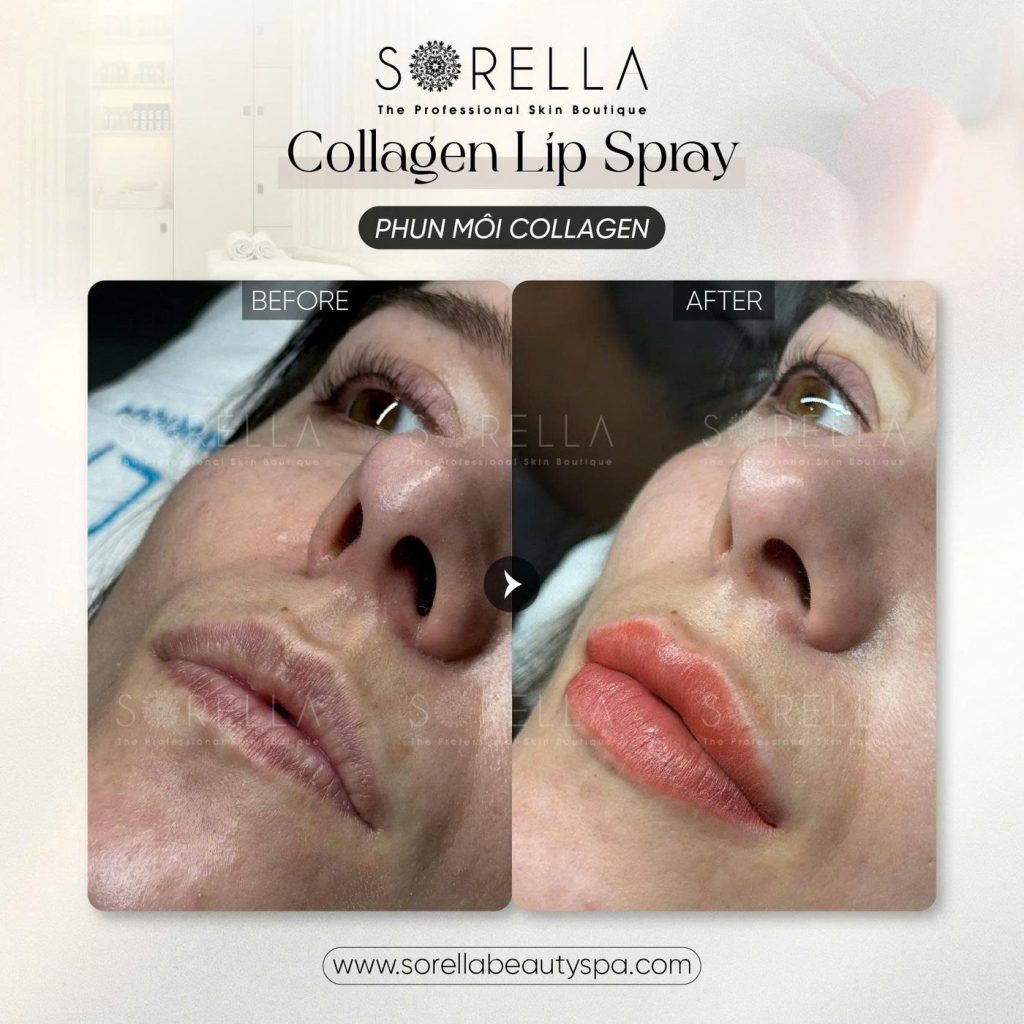 Before and after: Collagen Lip Spray at Sorella