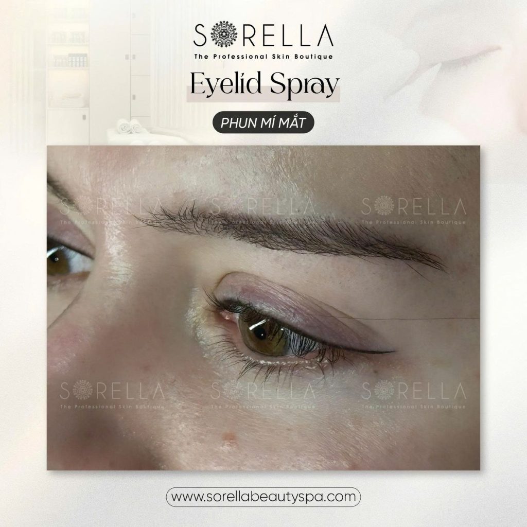 Before and after: Eyelid Spray at Sorella